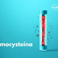 Homocysteina co to? Badanie poziomu homocysteiny w probówce z krwią.