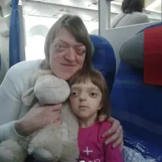 Kobieta i dziecko z zespołem Crouzona siedzą w samolocie, przytulając pluszową owieczkę.