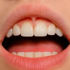 Usta z widocznymi zębami i językiem. Między górnymi jedynkami widoczny jest frenulum.