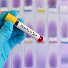Ręka w niebieskiej rękawiczce trzyma probówkę z napisem "Beta hCG Test". W tle widać rząd szkiełek mikroskopowych z fioletowymi plamami. Wynik badania hcg wolna podjednostka beta normy iu l.