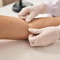 Ręce w rękawiczkach zakładają plaster na ramię po pobraniu krwi. Badanie na czczo zakończone.