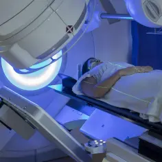 Pacjentka leży na stole terapeutycznym pod aparatem do radioterapii. Zielone linie lasera pomagają w precyzyjnym ustawieniu. To właśnie radioterapia co to jest, czyli leczenie chorób za pomocą promieniowania.