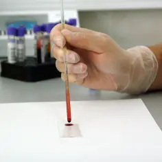 Ręka w rękawiczce pobiera próbkę krwi do analizy **hba1c**. W tle stojak z probówkami.