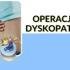 Ilustracja pokazuje kręgosłup z przepukliną dysku, która powoduje ucisk na nerw. Tekst informuje o operacji dyskopatii.