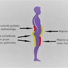 Schemat sylwetki z zaznaczonymi mięśniami. Widoczna pogłębiona lordoza lędźwiowa, wskazująca na napięcie mięśni grzbietu i brzucha.
