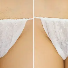 Bikini głębokie co to? Poznaj metody depilacji i efekty