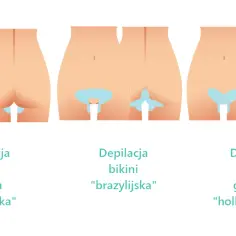 Depilacja bikini płytkie – co obejmuje i jakie ma zalety?