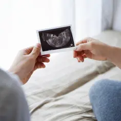 Para trzyma w dłoniach zdjęcie z USG, dokumentujące wczesna ciąża usg.