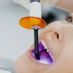 Jak wygląda wybielanie zębów u dentysty? Odkryj skuteczne metody i efekty