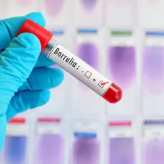 Jakie badanie na boreliozę wykonać po ukąszeniu kleszcza - pełna lista
