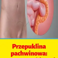 Jakiego lekarza wybrać przy przepuklinie pachwinowej? Dowiedz się teraz