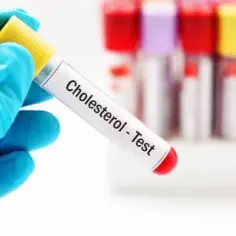 Czy cholesterol rośnie od stresu? Sprawdź, jak stres wpływa na zdrowie