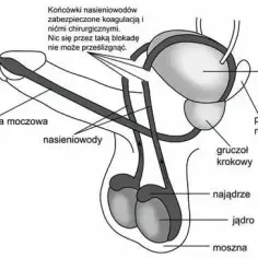 Czy wazektomia to grzech? Zrozumienie nauki Kościoła katolickiego