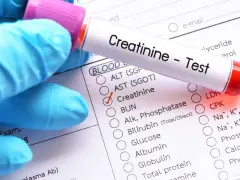 Rękawiczka w niebieskiej rękawiczce trzyma probówkę z napisem "Creatinine - Test". Obok znajduje się formularz z zaznaczoną opcją "Creatinine", sugerującą badanie kreatyniny w celu sprawdzenia jej normy.
