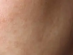 Zbliżenie na twarz z widoczną łuszczącą się skórą, która wymaga nawilżenia.