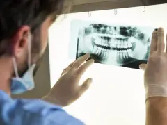 Jak często do dentysty? Pełny przewodnik: dzieci, dorośli, NFZ.