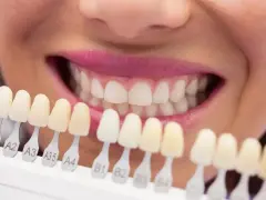 Uśmiechnięta kobieta prezentuje wzornik odcieni zębów, porównując je do swojego naturalnego koloru. Decyzja: wybielanie nakładkowe czy lampą?