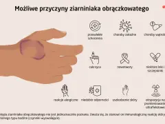 Dłoń z widocznym ziarniniakiem obrączkowatym. Obok ikony symbolizujące możliwe przyczyny: choroby, cukrzyca, nowotwory, leki, alergie, uszkodzenia skóry, promieniowanie UV.