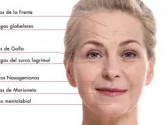 Rostro de mujer con líneas de expresión marcadas, mostrando arrugas estáticas en frente, ojos y alrededor de la boca.