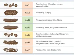 Typ 6 zeigt einzelne weiche Klümpchen mit unregelmäßigem Rand, was auf breiigen Stuhlgang hindeutet. Die Abbildung vergleicht verschiedene Stuhlformen.