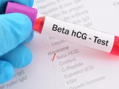 Rękawiczka w niebieskiej rękawiczce trzyma probówkę z krwią do testu Beta hCG. Na formularzu zaznaczono "Beta HCG" w sekcji "Hormone".