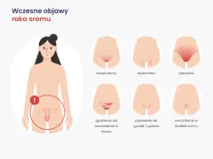 Wczesne objawy raka sromu: świąd, pieczenie, dyskomfort, zgrubienia, grudki, owrzodzenia. Zwróć uwagę na zmiany.