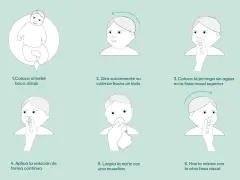 Ilustración paso a paso para el lavado nasal de un bebé. Incluye cómo colocarlo, girar su cabeza, usar la jeringa y limpiar su nariz.