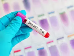 Ręka w niebieskiej rękawiczce trzyma probówkę z napisem "Borrelia - Test". To klucz do odpowiedzi, gdzie zrobić badania na boreliozę.