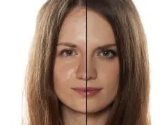 Viso diviso: a sinistra pelle con sebo e imperfezioni, a destra pelle uniformata dal trucco.