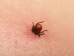 Jak bezpiecznie wyciągnąć kleszcza? Poradnik krok po kroku