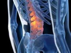 Anatomical rendering of a human spine with inflamed vertebrae, highlighted in orange and red.