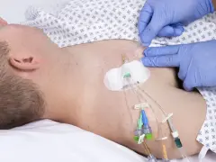 Ein Arzt mit blauen Handschuhen sichert einen zentralen Venenkatheter (pvk medizin) bei einem liegenden Patienten.