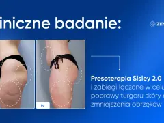Przed i po zabiegu presoterapii. Widoczne wyraźne presoterapia efekty: poprawa jędrności skóry i redukcja obrzęków.