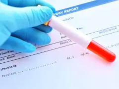 Ręka w niebieskiej rękawiczce trzyma probówkę z krwią nad raportem laboratoryjnym. Wynik badania ferrytyny to 62.3 ng/mL.