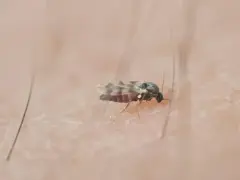 Mały meszek na skórze. Szukasz domowych sposobów na meszki? Ten owad może być uciążliwy.