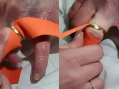 Pomoc w zdjęciu pierścionka z bardzo spuchniętego palca za pomocą pomarańczowej wstążki. Technika ta pomaga zmniejszyć obrzęk.