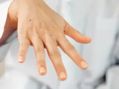 Una mano con algunas manchas, incluyendo un lunar visible en el dorso.
