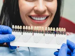 Uśmiechnięta kobieta z idealnymi zębami, dentysta dobiera kolor licówek. Sprawdź, jaka jest licówki cena.