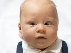 Zez u niemowlaka: Kiedy to norma, a kiedy pilna wizyta u okulisty?