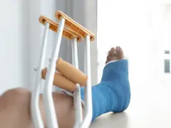 Noga w niebieskim gipsie, z kulami obok, sugeruje złamanie podudzia łącznie ze stawem skokowym.