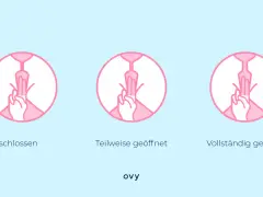 Darstellung des Muttermunds: geschlossen, teilweise geöffnet, vollständig geöffnet. Dies kann sich vor der Periode ändern.