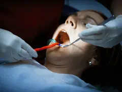Dentysta bada usta pacjentki, która cierpi na ropień zęba. Widoczne narzędzia stomatologiczne i rozwierak.
