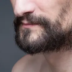 Gros plan sur le menton d'un homme, montrant une barbe foncée et clairsemée. On aperçoit un trou dans la barbe, signe d'une perte de barbe.