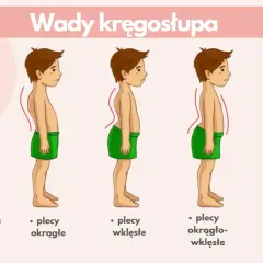 Ilustracja pokazuje wady postawy u dzieci: plecy okrągłe, wklęsłe, okrągło-wklęsłe i płaskie. Prawidłowa postawa jest kluczowa.