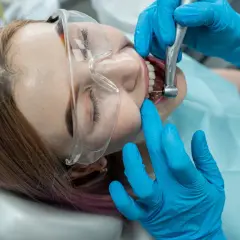 Pacjentka w okularach ochronnych przechodzi leczenie kanałowe. Dentysta w niebieskich rękawiczkach używa wiertła, by ulżyć w bólu zęba.