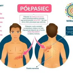 Ilustracja przedstawia objawy półpaśca, w tym ból, pieczenie i wysypkę w formie pasa pęcherzy. Nietypowe objawy półpaśca mogą obejmować również gorączkę i zmęczenie.