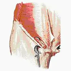 Illustration anatomique montrant la région du périnée masculin, utile pour comprendre l'inflammation périnée homme traitement.