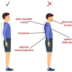 Ilustracja porównująca prawidłową i nieprawidłową postawę ciała, z zaznaczonym bólem pleców.