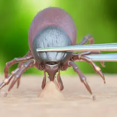 Gros plan d'une tique s'accrochant à la peau, avec des pinces prêtes à la retirer. La durée pendant laquelle une tique reste accrochée varie.