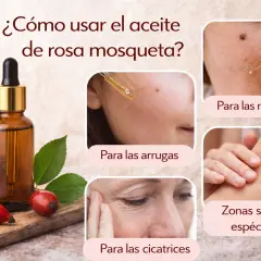 Aceite de rosa mosqueta: ideal para arrugas, manchas, cicatrices y zonas secas.